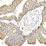 Cytokeratin 8 Antibody in Immunohistochemistry (Paraffin) (IHC (P))