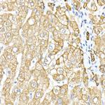 Cytokeratin 8 Antibody in Immunohistochemistry (Paraffin) (IHC (P))