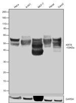 Cytokeratin 8 Antibody in Western Blot (WB)