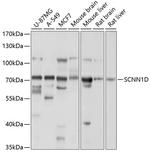 SCNN1D Antibody in Western Blot (WB)