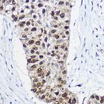 SMARCA1 Antibody in Immunohistochemistry (Paraffin) (IHC (P))