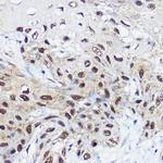 SMARCA1 Antibody in Immunohistochemistry (Paraffin) (IHC (P))