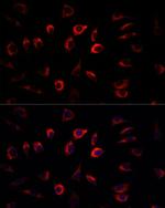 SGK1 Antibody in Immunocytochemistry (ICC/IF)