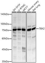 TBX2 Antibody in Western Blot (WB)