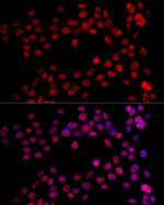 NR2F2 Antibody in Immunocytochemistry (ICC/IF)