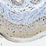 14-3-3 sigma Antibody in Immunohistochemistry (Paraffin) (IHC (P))