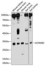 KCNMB2 Antibody in Western Blot (WB)