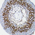 ICMT Antibody in Immunohistochemistry (Paraffin) (IHC (P))