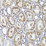 SNAPAP Antibody in Immunohistochemistry (Paraffin) (IHC (P))