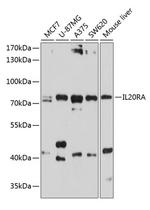 IL20RA Antibody in Western Blot (WB)