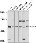 Asporin Antibody in Western Blot (WB)