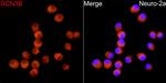 SCN3B Antibody in Immunocytochemistry (ICC/IF)