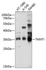 TNNT1 Antibody in Western Blot (WB)