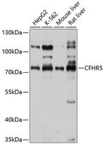 CFHR5 Antibody in Western Blot (WB)