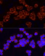 GCLC Antibody in Immunocytochemistry (ICC/IF)