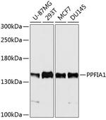 PPFIA1 Antibody in Western Blot (WB)