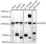 CORIN Antibody in Western Blot (WB)