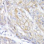 SEMA4F Antibody in Immunohistochemistry (Paraffin) (IHC (P))