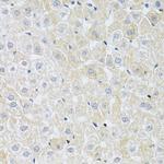 SLC4A5 Antibody in Immunohistochemistry (Paraffin) (IHC (P))