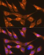 LMAN1 Antibody in Immunocytochemistry (ICC/IF)