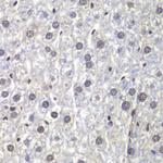 U2AF1 Antibody in Immunohistochemistry (Paraffin) (IHC (P))