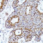 AKR1C2 Antibody in Immunohistochemistry (Paraffin) (IHC (P))