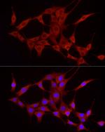 TREM2 Antibody in Immunocytochemistry (ICC/IF)