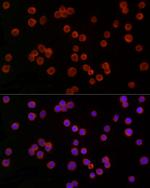 TREM2 Antibody in Immunocytochemistry (ICC/IF)