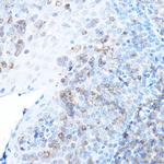MULT1 (NKG2D Ligand) Antibody in Immunohistochemistry (Paraffin) (IHC (P))
