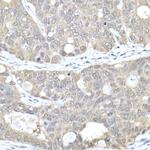 MTAP Antibody in Immunohistochemistry (Paraffin) (IHC (P))