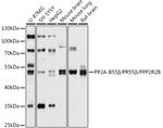 PPP2R2B Antibody in Western Blot (WB)