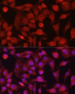 RASGRP1 Antibody in Immunocytochemistry (ICC/IF)