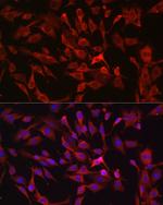 RASGRP1 Antibody in Immunocytochemistry (ICC/IF)