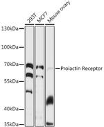 Prolactin Receptor Antibody in Western Blot (WB)