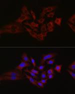 HK1 Antibody in Immunocytochemistry (ICC/IF)