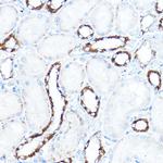 HK1 Antibody in Immunohistochemistry (Paraffin) (IHC (P))