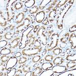 HK1 Antibody in Immunohistochemistry (Paraffin) (IHC (P))