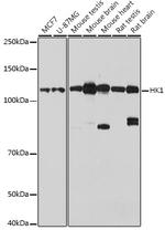 HK1 Antibody in Western Blot (WB)