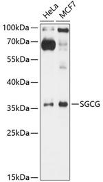 SGCG Antibody in Western Blot (WB)