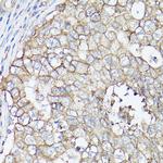 SLC16A3 Antibody in Immunohistochemistry (Paraffin) (IHC (P))