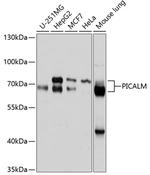 CALM Antibody in Western Blot (WB)