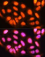 14-3-3 epsilon Antibody in Immunocytochemistry (ICC/IF)