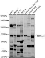 SLC6A14 Antibody in Western Blot (WB)