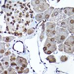 SEC14L2 Antibody in Immunohistochemistry (Paraffin) (IHC (P))