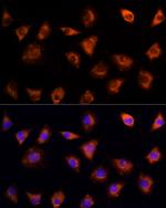 IL17C Antibody in Immunocytochemistry (ICC/IF)