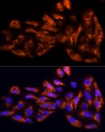 IL17C Antibody in Immunocytochemistry (ICC/IF)