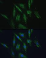 SRPRB Antibody in Immunocytochemistry (ICC/IF)