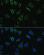 SRPRB Antibody in Immunocytochemistry (ICC/IF)