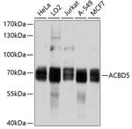 ACBD5 Antibody in Western Blot (WB)