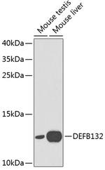 DEFB132 Antibody in Western Blot (WB)